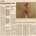 Beijo pode transmitir o HPV