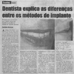 Dentista explica as diferenças entre os métodos de implante